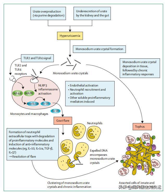 痛风研究最新进展及发展趋势分析