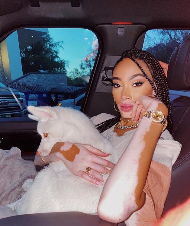 最新白癜风治疗研究进展及其论述