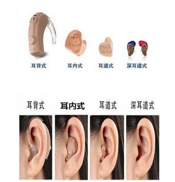 惠耳听力助听器价格指南,如何选购适合自己的助听器及价格解析