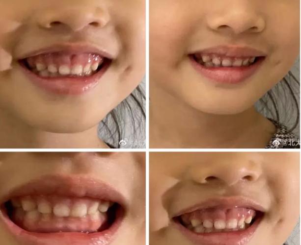 露笑科技股票行情深度分析与前景展望