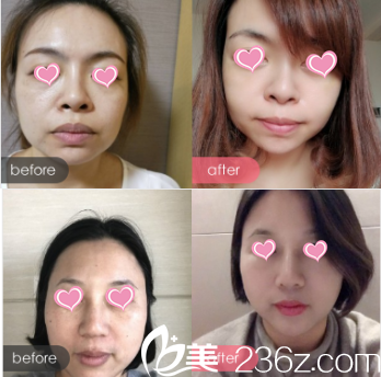 全面解读整容价格单，整容费用构成一览