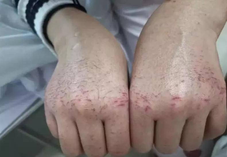 新款肺炎最新动态,科技革新助力智能防控,守护您的健康生活