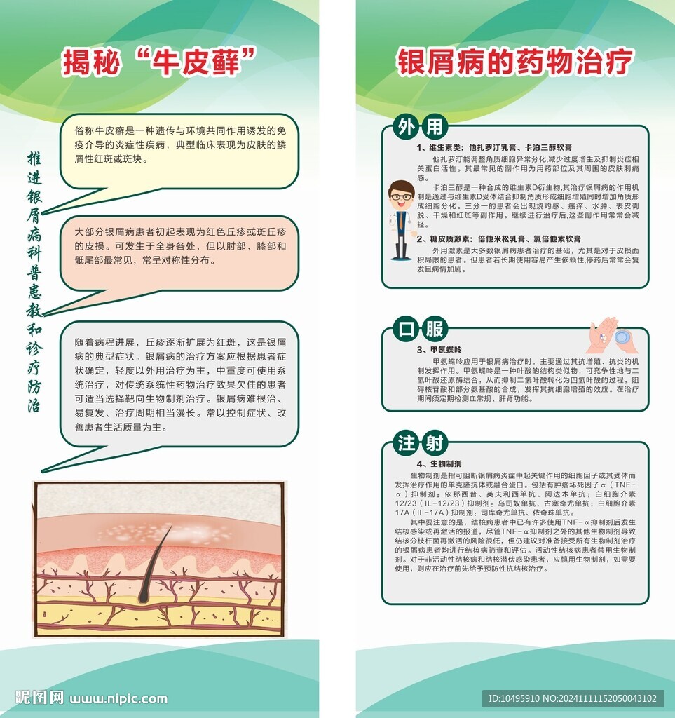 牛皮癣最新治疗方法探索，小巷深处的秘密小店经验分享